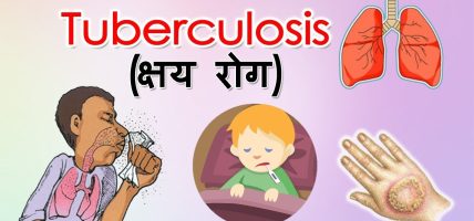 के हो क्षयरोग ? नेपालमा के छ अवस्था